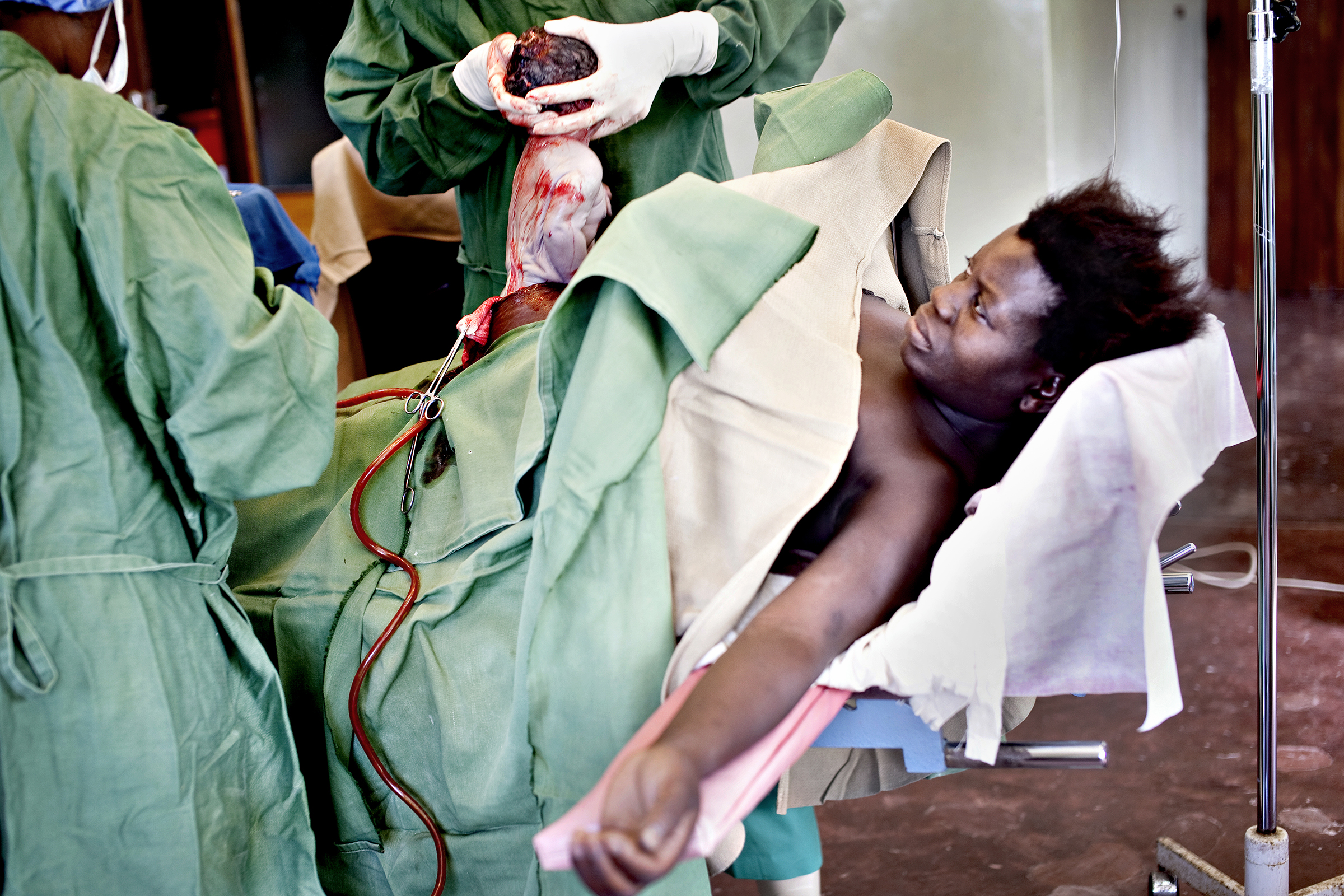 St. Joseph’s Hospital, Chiradzulu, Malawi, 2010: Chrissy Andrew er heldigvis på et sykehus hvor de kan gjennomføre keisersnitt når fødselen ikke går av seg selv. Kun seks prosent av hennes malawiske medsøstre har lege til stede under fødsel. Over 99 prosent av dem som dør av svangerskapsrelaterte komplikasjoner bor i fattige land.